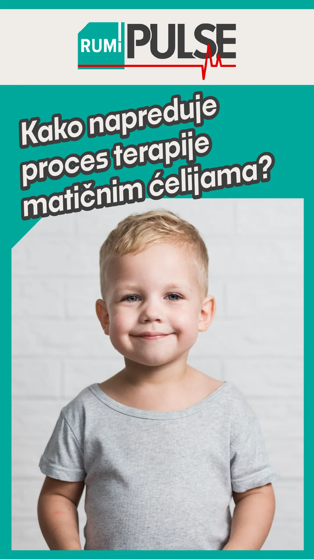 Autizam terapija za djecu